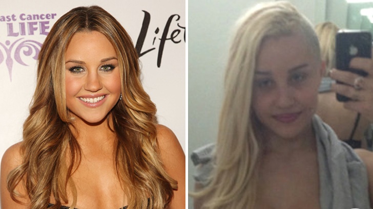 Amanda Bynes - Las 16 peores cirugías de famosos WTF!