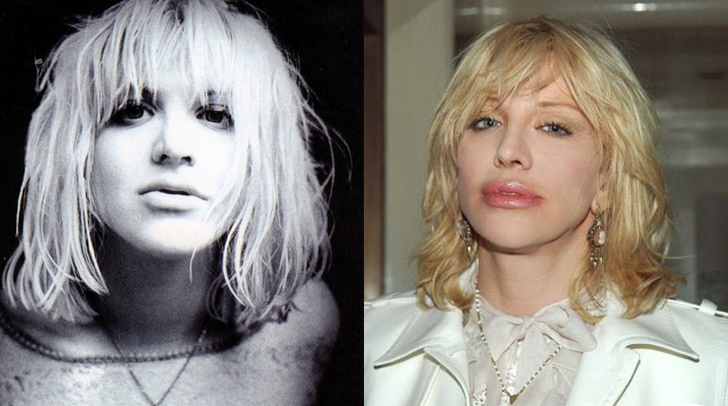 courtney love  - Las 16 peores cirugías de famosos WTF!