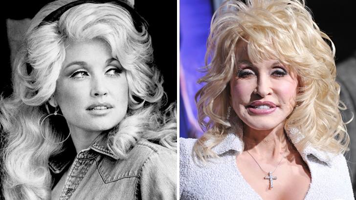 dolly parton  - Las 16 peores cirugías de famosos WTF!