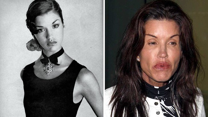 janice dickinson - Las 16 peores cirugías de famosos WTF!