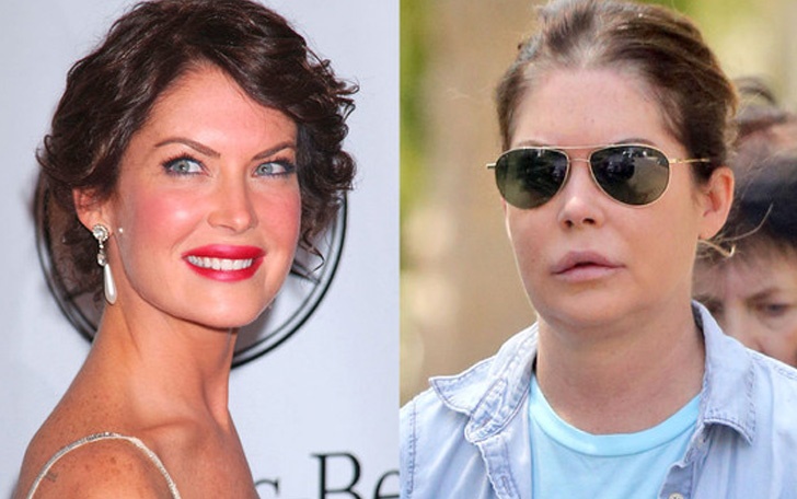 lara flynn boyle - Las 16 peores cirugías de famosos WTF!