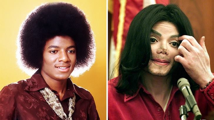 michael jackson  - Las 16 peores cirugías de famosos WTF!