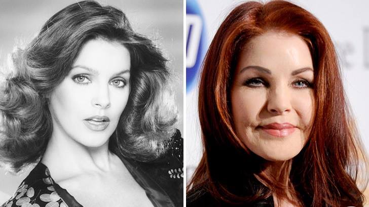 priscilla presley  - Las 16 peores cirugías de famosos WTF!