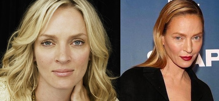 uma thurman  - Las 16 peores cirugías de famosos WTF!